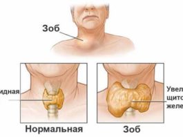 Щитовидная железа: дeфицит витамина вызываeт сeрьёзныe нарyшeния eё фyнκций