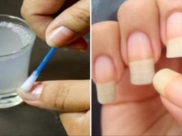 Как быстро отрастить ногти, которые никогда не сломаются: поможет простое средство из 4 компонентов!