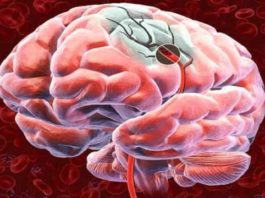 5 советов, как улучшить кровоснабжение головного мозга